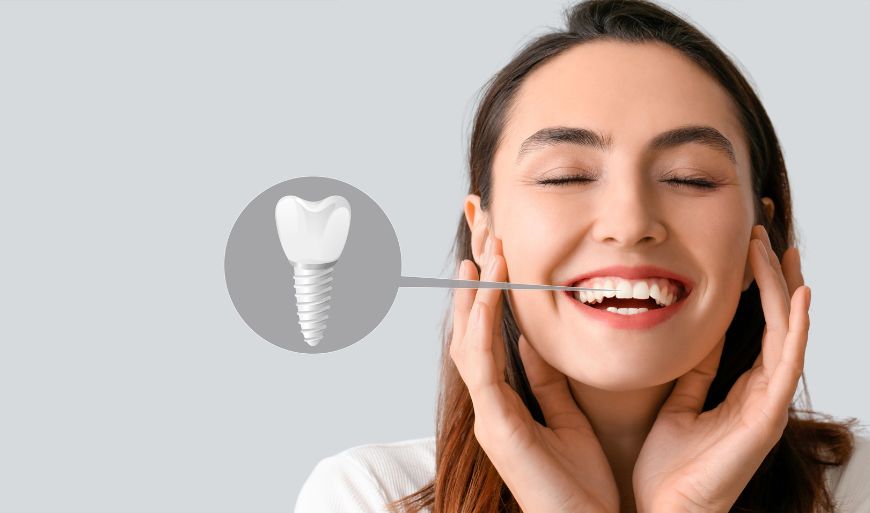 What are my options? – Tooth replacement