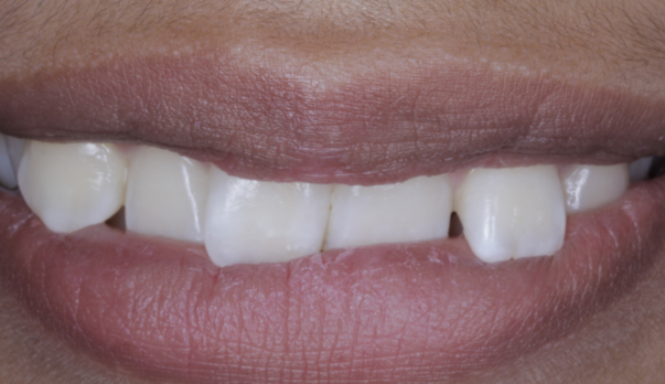After close up mouth