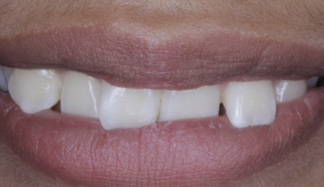 After close up mouth