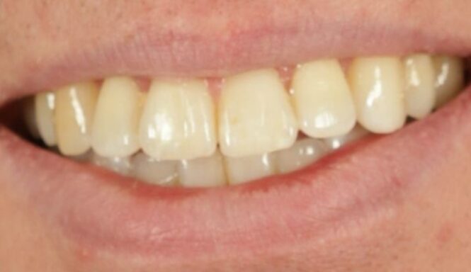 After - Alexandra Dental