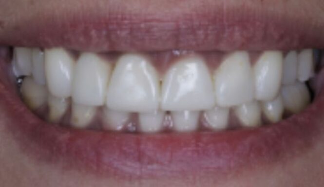 After - Alexandra Dental