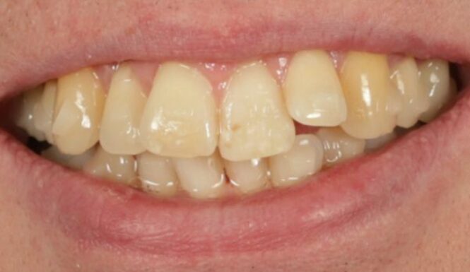 Before - Alexandra Dental