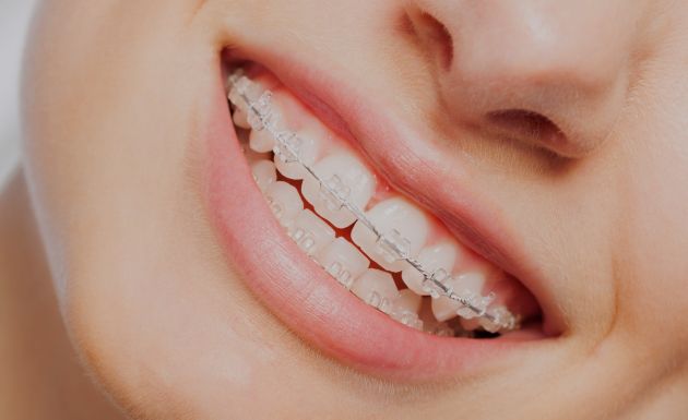Treatment - Alexandra Dental