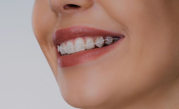 Treatment - Alexandra Dental