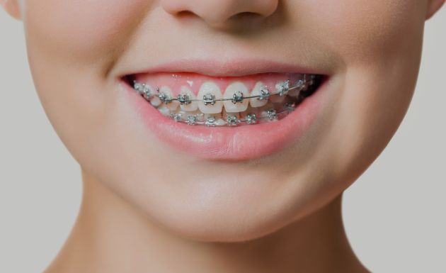 Treatment - Alexandra Dental