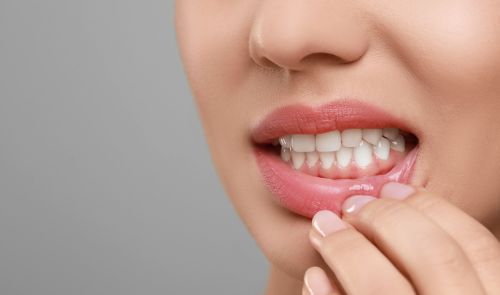 Healthy teethgums