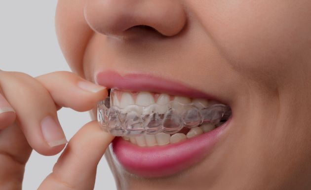 Treatment - Alexandra Dental