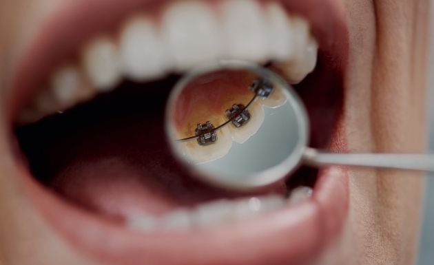 Treatment - Alexandra Dental