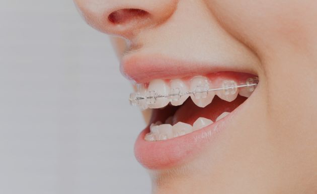 Treatment - Alexandra Dental