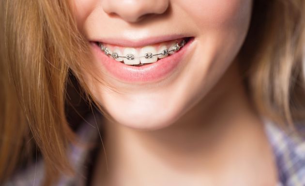 Treatment - Alexandra Dental