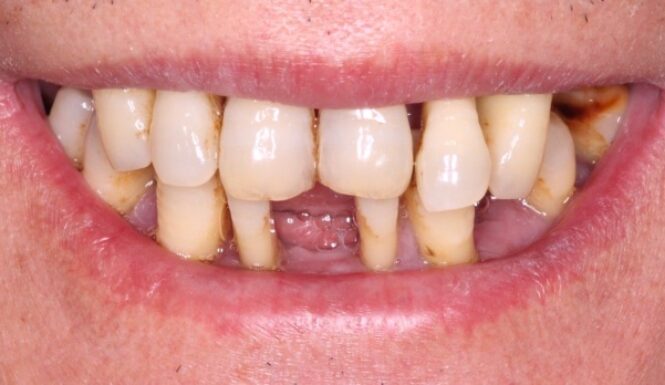 Case 1 Before