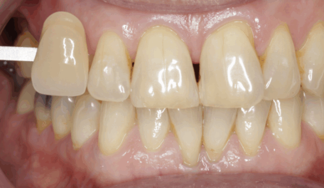 Before - Alexandra Dental