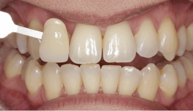 Before - Alexandra Dental
