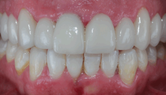 After - Alexandra Dental