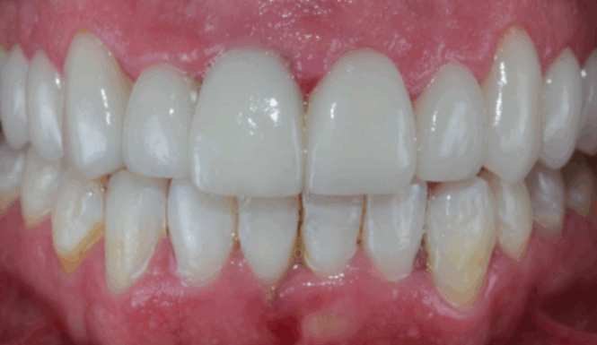 After - Alexandra Dental