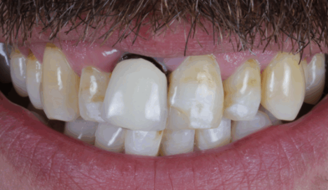 Before - Alexandra Dental