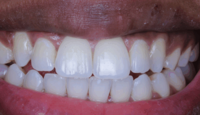 After - Alexandra Dental