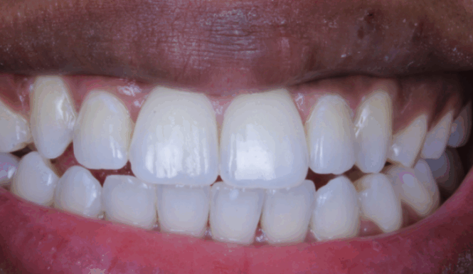 After - Alexandra Dental