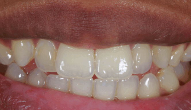 Before - Alexandra Dental