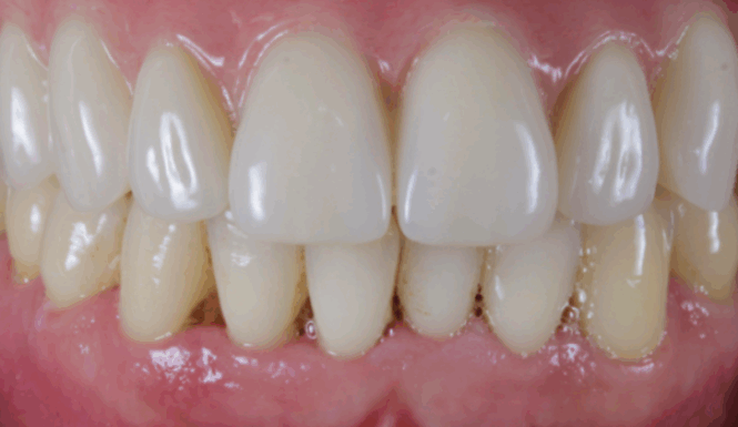 After - Alexandra Dental