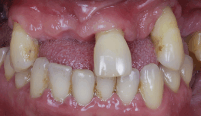Before - Alexandra Dental