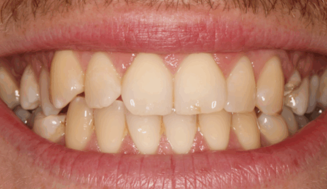 Before - Alexandra Dental