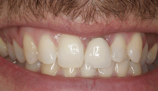 After - Alexandra Dental