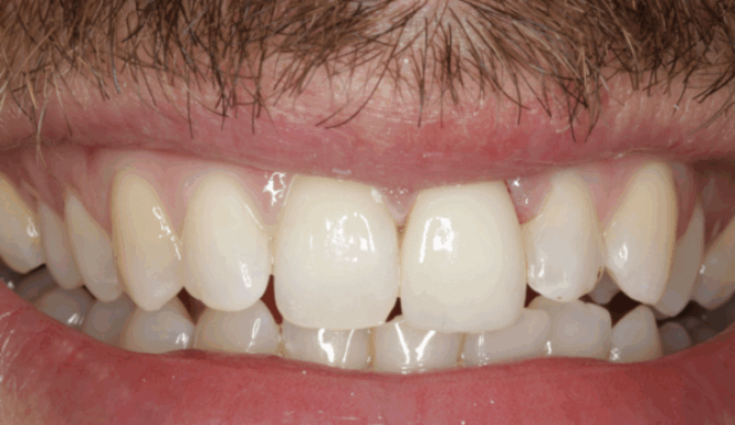 Before - Alexandra Dental