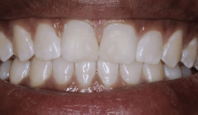 After - Alexandra Dental