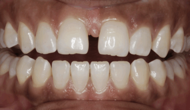 Before - Alexandra Dental