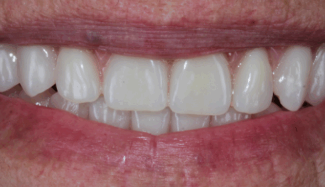After - Alexandra Dental