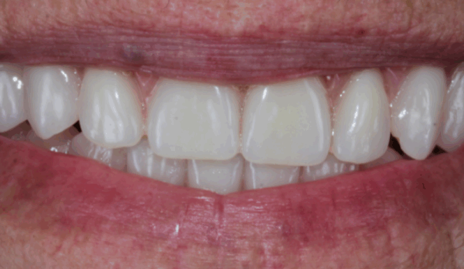 After - Alexandra Dental