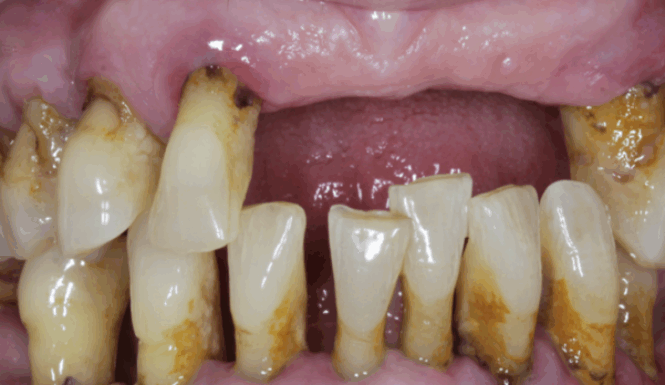 Before - Alexandra Dental